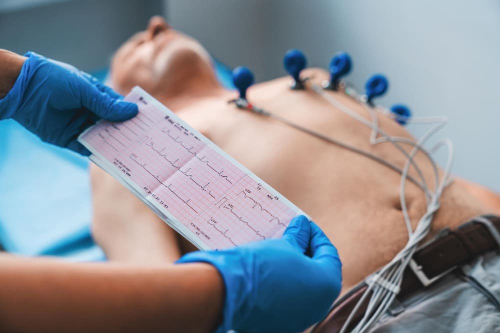 Electrocardiograma (ECG) de reposo